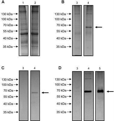 An Oleuropein β-Glucosidase from Olive Fruit Is Involved in Determining the Phenolic Composition of Virgin Olive Oil